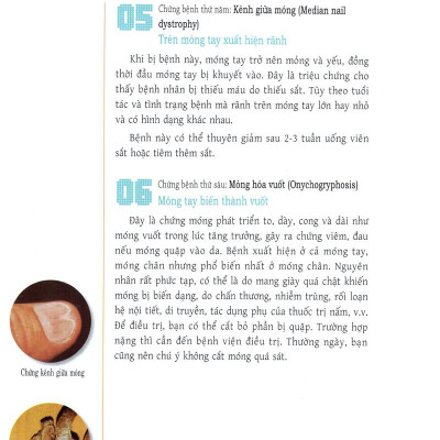 Trang Điểm Móng - Cách Thể Hiện Bản Thân Của Những Cô Gái Tự Tin