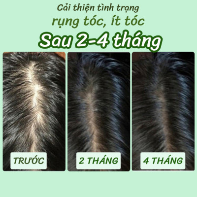 Hỗn hợp ủ tóc 7in1 dưỡng tóc chắc khỏe, thúc đẩy tóc mọc nhanh, mọc nhiều
