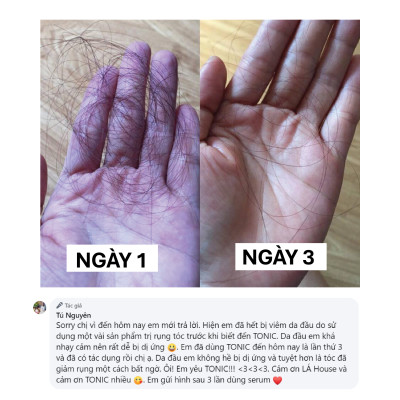 SERUM GIẢM GÃY RỤNG TÓC HAIR RECOVERY SERUM 50ml