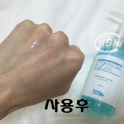 Gel Tẩy Tế Bào Chết Ez Peeling TBM (300ml) (Hàng Chính Hãng)