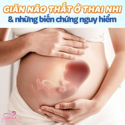 Combo 05 hộp Sữa non Al SAFAA Life